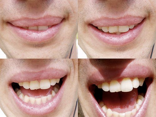 How IT Professionals Can Get B2B Word Of Mouth